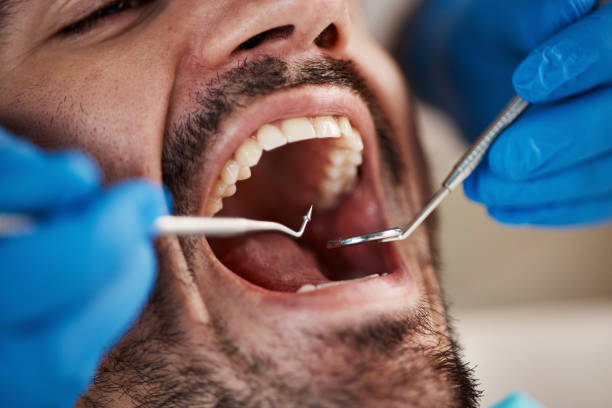 Laser Dentistry in Falkville, AL